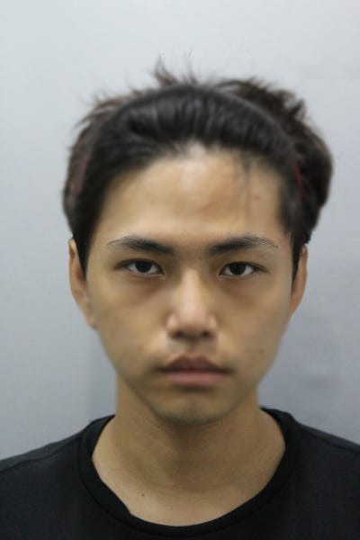 압구정쌍꺼풀 수술 실패 예방하고 싶다면 필독 사진 6