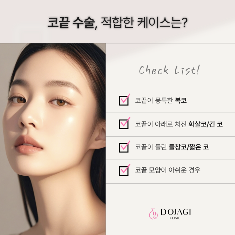 성형외과 전문의가 말하는 코끝연골재배치의 기준 사진 3