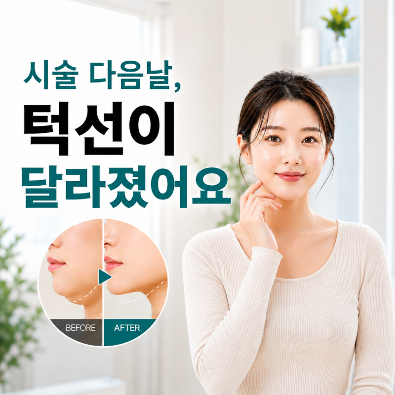 피팅레이저, 얼굴리프팅과 이중턱까지 한번에