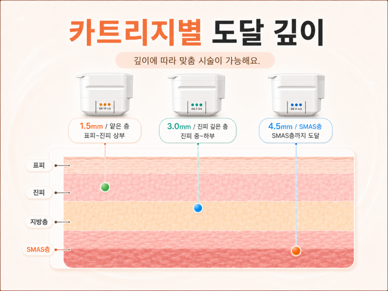 강남울쎄라리프팅, 비싸고 아픈 만큼 효과 있을까?