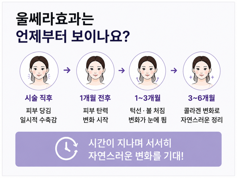 강남울쎄라, 아픈데 효과 없을까 걱정된다면? 사진 3
