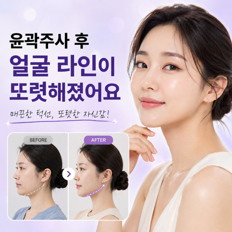 강남 윤곽주사 1회만으로 될까? 얼굴형부터 확인하세요