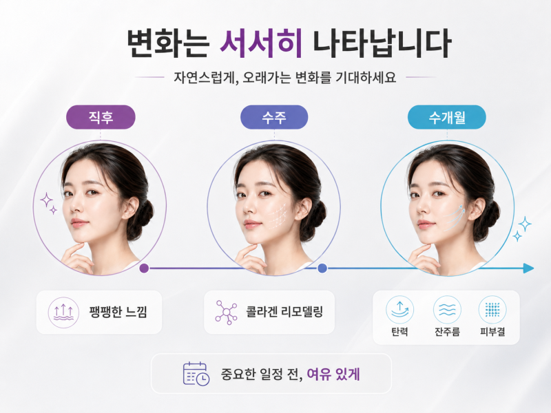 강남써마지와 울쎄라, 결과가 달라지는 이유 사진 9