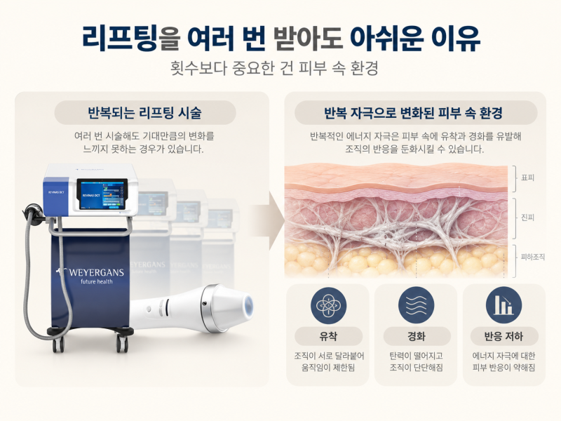신논현역피부과 레비나스, 리프팅을 반복해도 얼굴선이 아쉽다면? 사진 2