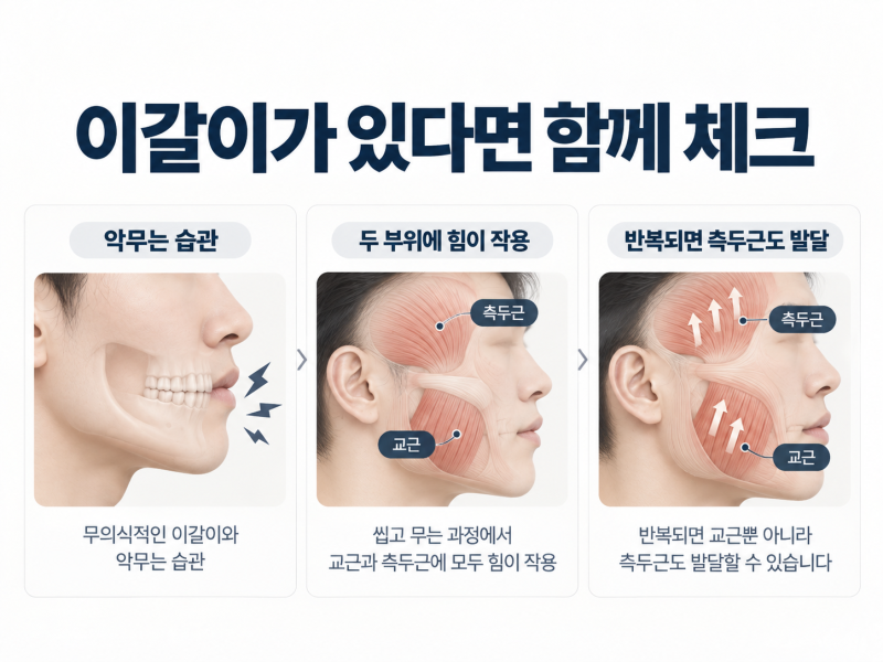 신논현역피부과 남자사각턱보톡스, 남자가 맞아도 자연스러울까요? 사진 6